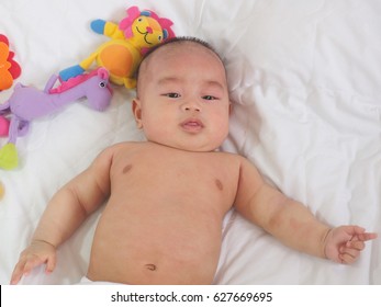 Atopic Dermatitis In Asian Baby