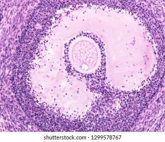 Atretic Tertiary Ovarian Follicle. The Granulosa Cells Show An Extensive Process Of Apoptosis. The Oocyte Also Show Signs Of Cell Death.