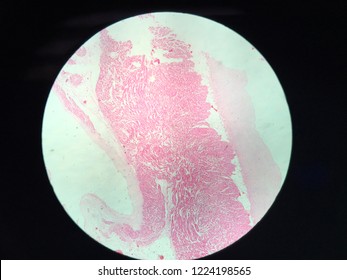 Atrium Valve Consist Of Epicardium Myocardium And Endocardium From Left To Right