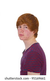 Attractive Boy In Puberty With Red Hair