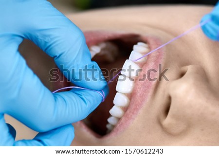 Attractive girl in a dental clinic. Dentist in blue latex gloves is flossing her teeth with a help of a dental floss. Closeup horizontal photo.