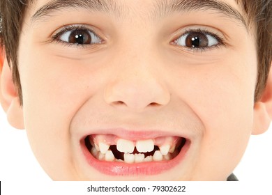 Attractive Young Boy With Missing Teeth Close Up Detail.