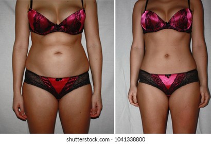 Authentic real amateurish before and after weight loss photo of female body. 