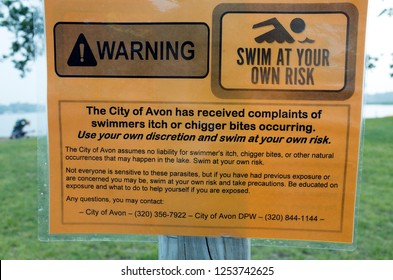 AVON, MINNESOTA - JULY 03, 2015: Warning Sign For Swimmers Itch And Chigger Bites From Swimming In Middle Spunk Lake. 