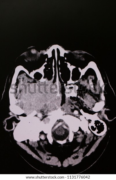 Axial Plain Sagittal Cut Ct Scan Stock Photo 1131776042 | Shutterstock