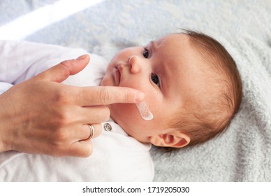 Baby With Atopic Dermatitis Getting Cream Put. Care And Prevention Of Eczema. Keep Your Baby From Itching