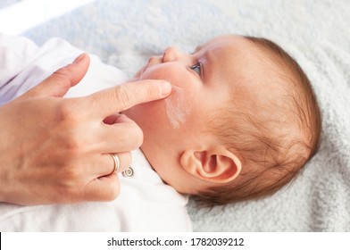 Baby With Atopic Dermatitis Getting Cream Put. Care And Prevention Of Eczema. Keep Your Baby From Itching