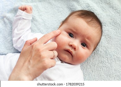 Baby With Atopic Dermatitis Getting Cream Put. Care And Prevention Of Eczema. Keep Your Baby From Itching