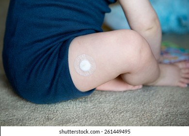 Baby With Bandaid After Vaccination Or Needle Or A Sore Leg.  