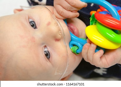 Baby In A Children's Hospital With A Breathing Tube Getting Medical Treatment.