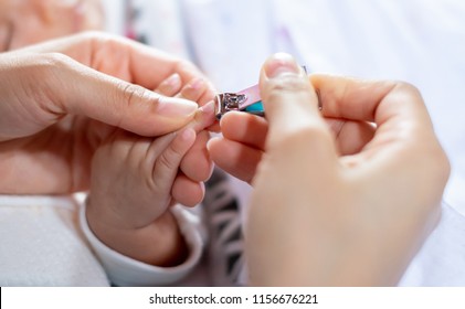 clipped baby's finger while cutting nails