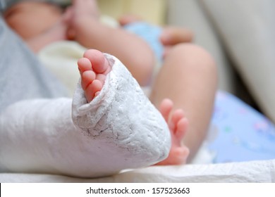 Baby Foot In Bandage And Cast 