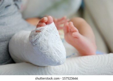 Baby Foot In Bandage And Cast 