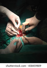 Baby Heart Surgery