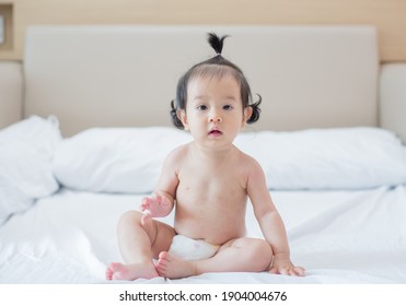 Hautausschlag für Säuglinge, prickelnde Hitze für das Baby