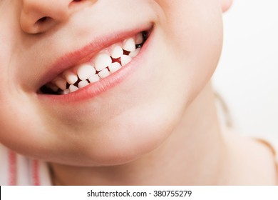 Baby Smile Close. White Teeth Of A Child Isolated On A White Background
