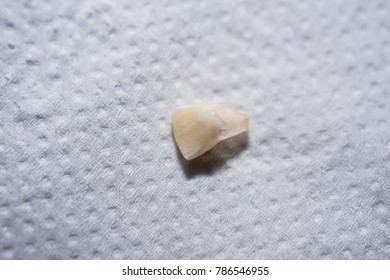 Baby Tooth Blood Stain On White Stock Photo 786546955 | Shutterstock