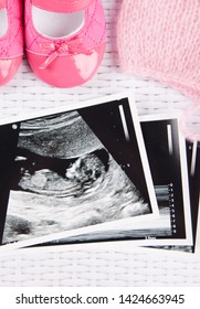 Baby Ultrasound Pictured With Pink Baby Shoes & Bonnet