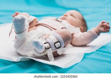 A Baby Wearing A Harness That Corrects Hip Dysplasia