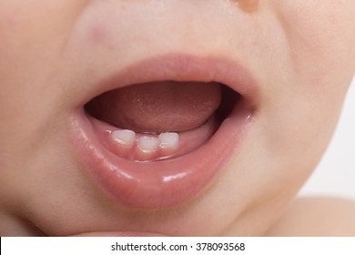 The Baby's Mouth With Milk Teeth