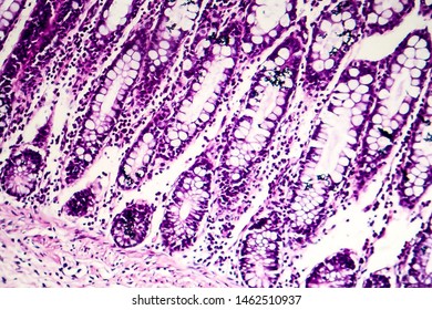 Bacillary Dysentery Light Micrograph Photo Under Stock Photo 1462510907 ...