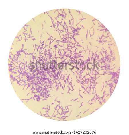 Bacillus anthracis is the etiologic agent of anthrax—a common disease of livestock and, occasionally, of humans.