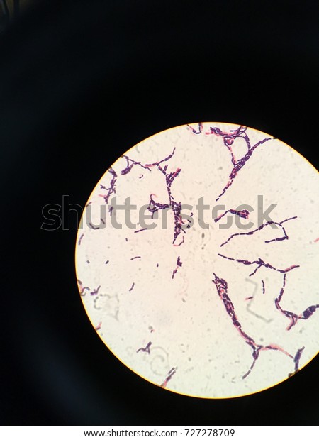 Bacillus Megaterium Gram Stain Stock Photo Edit Now 727278709