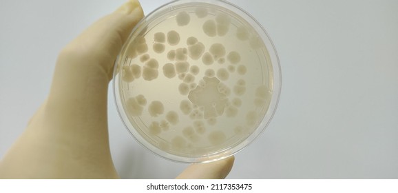 Bacillus Subtilis Growth Result Photo