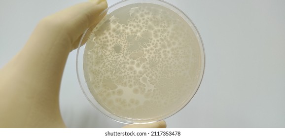 Bacillus subtilis growth result photo - Shutterstock ID 2117353478