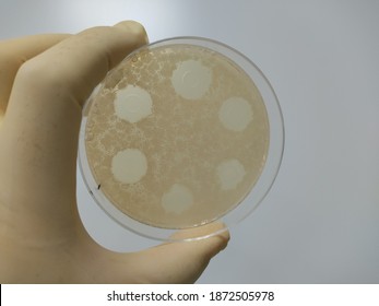 Bacillus Subtilis Microbial Assay Test