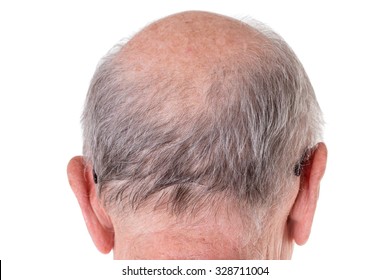 Back Of The Bald Head Of Old Man. Back View. Isolated On A White Background.