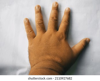 The Back Of The Fat Hand Is Brown On A White Background