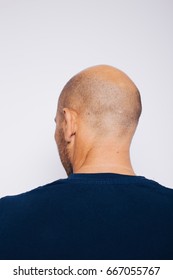 the back of the head the bald man