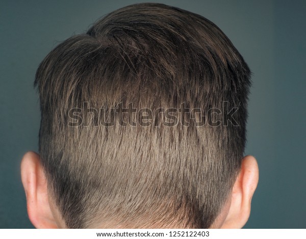 Back Head Male Person Slick Hair Stock Photo Edit Now 1252122403