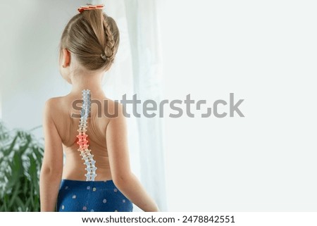 back little girl with scoliosis, child 5 years old crookedly standing, spine deformity curved, orthopedic condition, need for medical attention