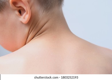 Back And Neck Of A Child, Boy 6-7 Years Old, The Concept Of Body Hygiene, Physical Condition, Daily Morning Routineskin, Neck, Scoliosis