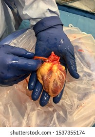 Back Table Explanted Pediatric Heart For Recipient