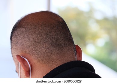 back view head thai man thin bald hair