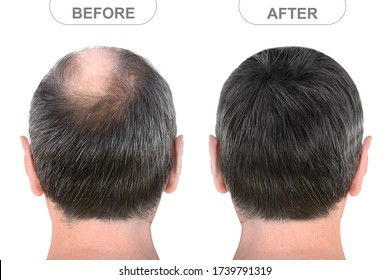 Back view of male head before and after hair extensions