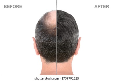 Back View Of Male Head Before And After Hair Extensions