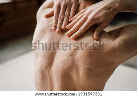Similar – Image, Stock Photo Male shoulder with scars after shoulder arthroscopy surgery. Chronic dislocation of long biceps tendon after surgery. Tendon rupture shoulder.