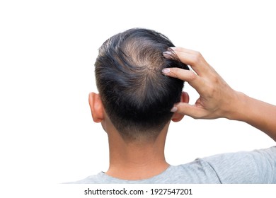 The back view of a man's head  The back view of a man's head  hair loss ,White background die cut - Shutterstock ID 1927547201