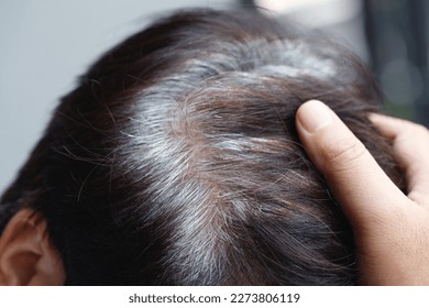 Back view of young people premature gray hair, showing black hoary hair roots on head change to senior old man outdoor.