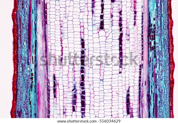 Background Abscission Layer Cell Under Microscope Royalty Free