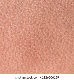 Background Of A Pink Skin Texture Of A Man Covered With Pores And Small Goosebumps