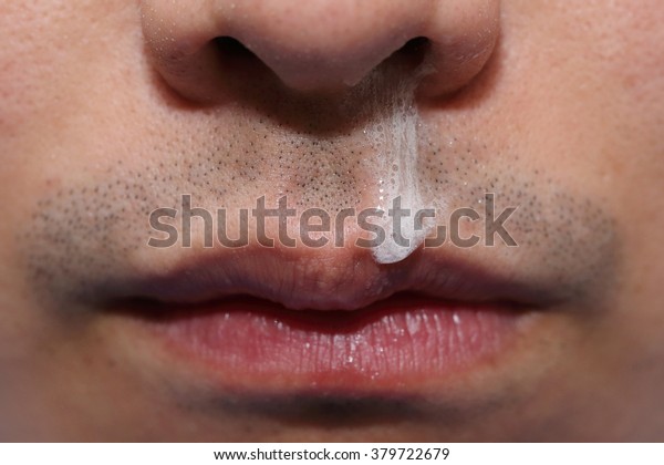background of running nose of\
sick man