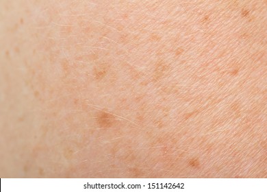 Background Of The Skin With Freckles. Macro