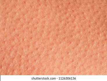 Background Of A Texture Of A Tanned Young Female Skin Of A Man Covered With Pores And Small Goosebumps