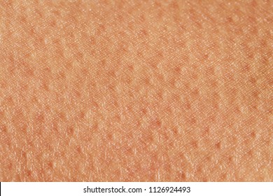 Background Of A Texture Of A Tanned Young Female Skin Of A Man Covered With Pores And Small Goosebumps