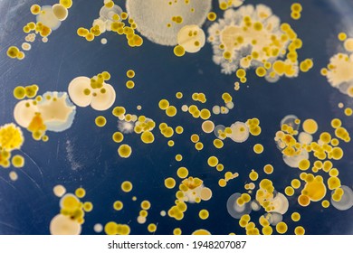 Hintergründe der Eigenschaften und Verschiedene geformte Kolonie von Bakterien und Mold wachsen auf Agar-Platten aus Bodenproben für die Ausbildung im Labor für Mikrobiologie.
